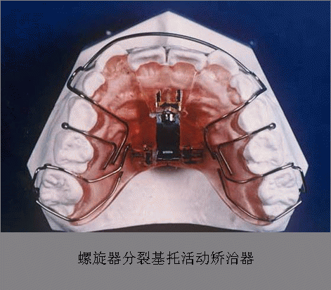 足球即时比分:向传统信报箱说拜拜私家驿站智能信包箱正式发布!(图2) 足球即时比分